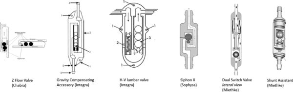 shunt systems
